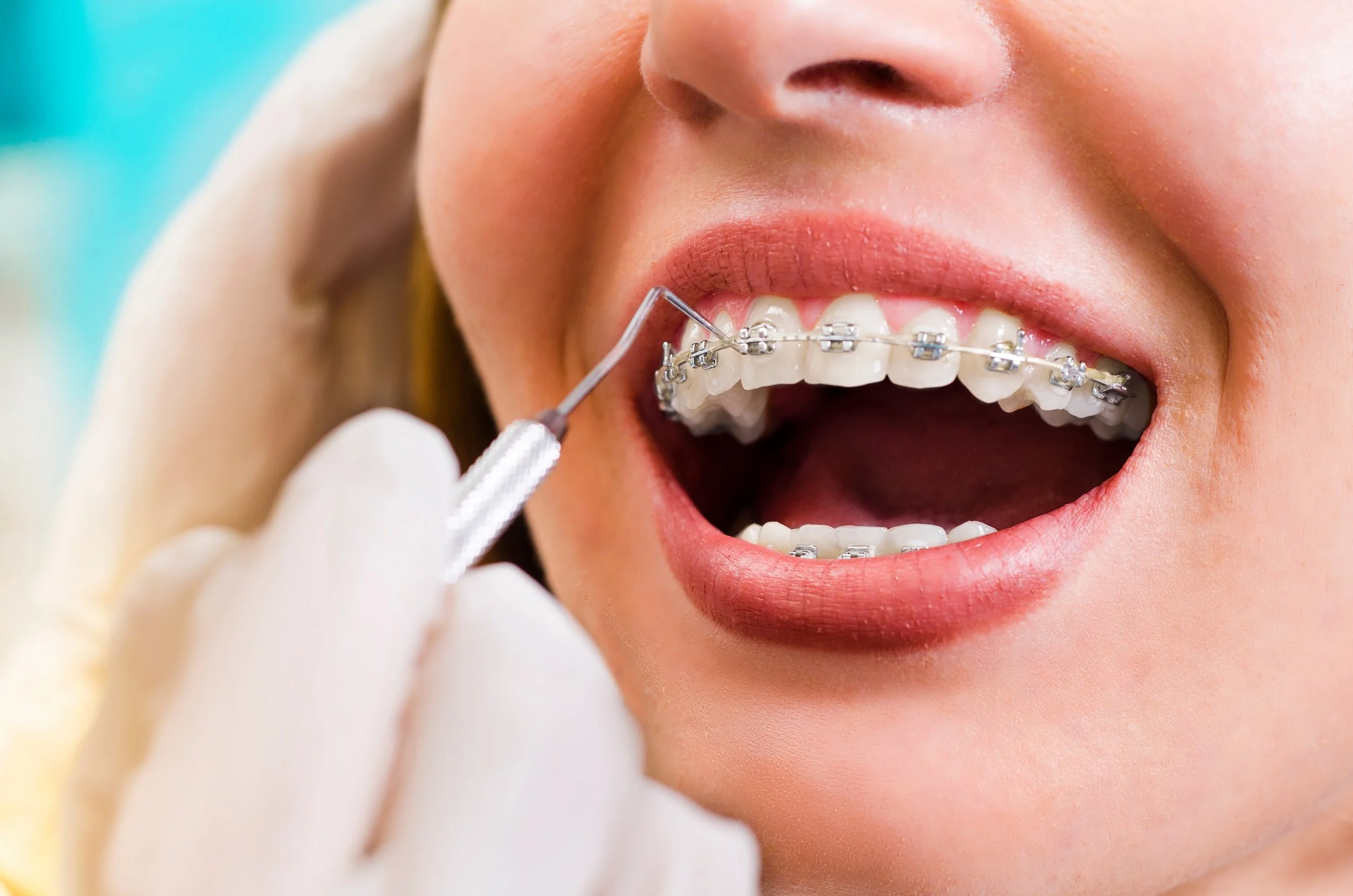 Orthodontics Treatment  Georgetown