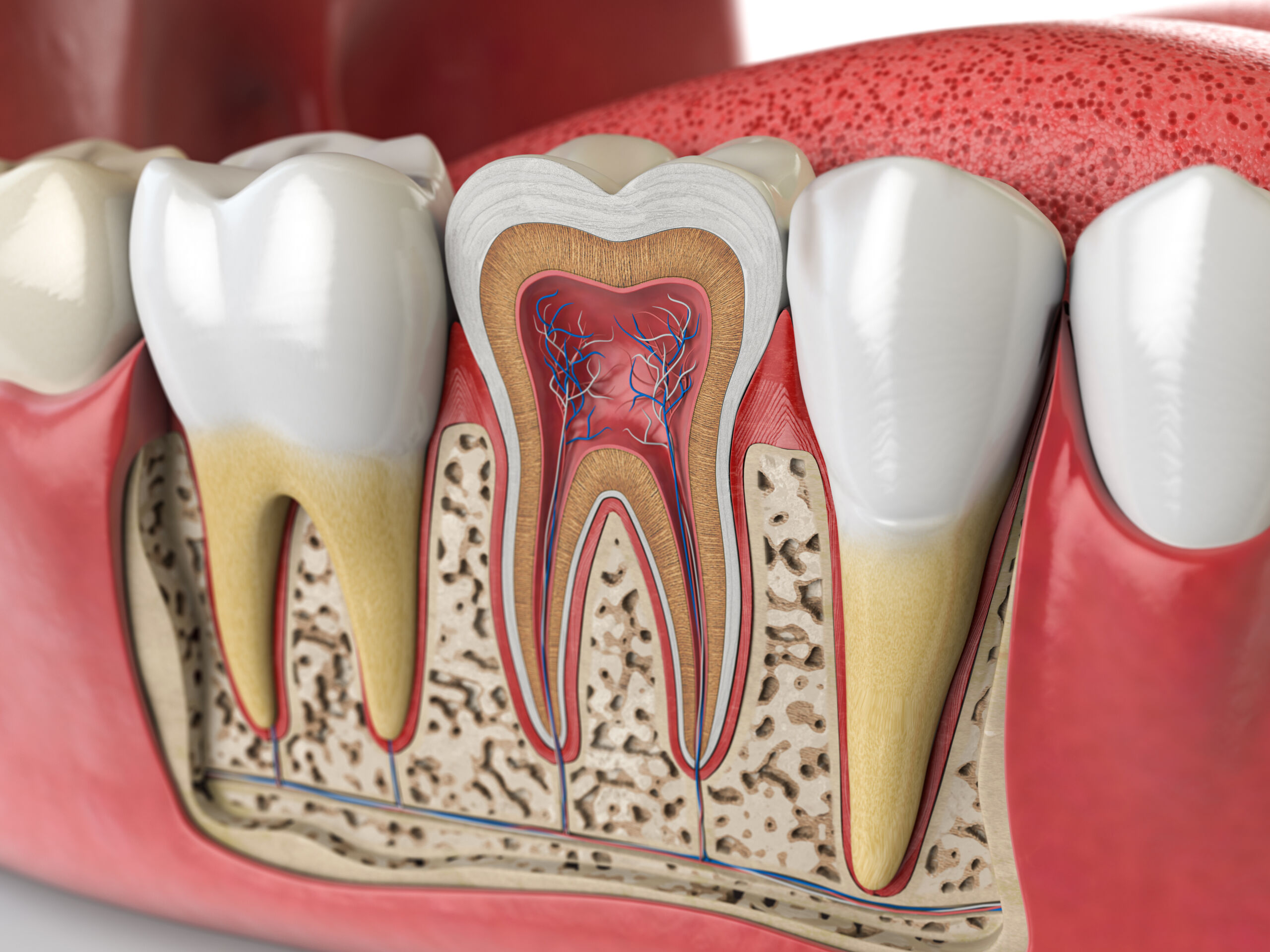 Root Canals In Georgetown