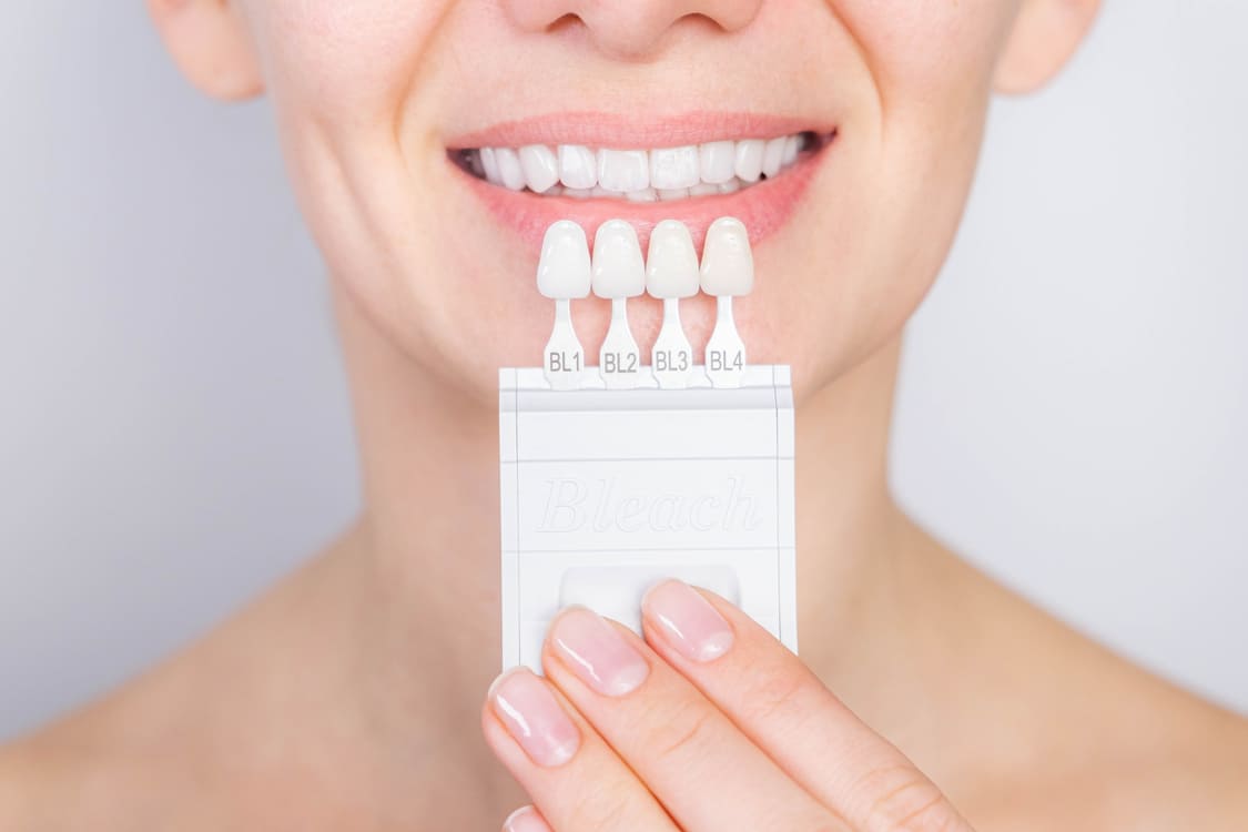 Dental Veneers In Georgetown